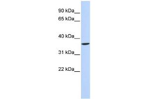 WB Suggested Anti-SHOX2 Antibody Titration: 0. (SHOX2 抗体  (N-Term))