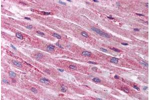 Human Heart (formalin-fixed, paraffin-embedded) stained with HIF1AN antibody ABIN214112 at 5 ug/ml followed by biotinylated goat anti-rabbit IgG secondary antibody ABIN481713, alkaline phosphatase-streptavidin and chromogen.