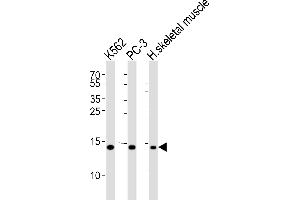 Western blot analysis of lysates from K562, PC-3 cell line and human skeletal muscle tissue lysate(from left to right), using HIST1H2BM Antibody (N-term) (ABIN6243575 and ABIN6577461). (HIST1H2BM 抗体  (N-Term))