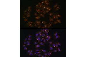 Immunofluorescence analysis of U-2 OS cells using SNX1 Rabbit pAb (ABIN6128725, ABIN6148234, ABIN6148235 and ABIN6224727) at dilution of 100 (40x lens). (Sorting Nexin 1 抗体  (AA 1-150))