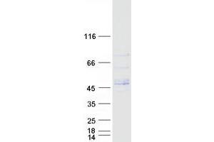 Western Blotting (WB) image for Leucine Rich Repeat Containing 42 (LRRC42) protein (Myc-DYKDDDDK Tag) (ABIN2724918)