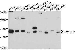 Western blot analysis of extracts of various cell lines, using TRMT61A antibody (ABIN5999106) at 1/1000 dilution. (TRMT61A 抗体)