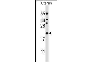 CDKN1B Antibody (C-term) (ABIN657225 and ABIN2846327) western blot analysis in human normal Uterus tissue lysates (35 μg/lane). (CDKN1B 抗体  (C-Term))