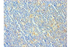 Immunohistochemistry of paraffin-embedded human tonsil tissue using ABIN7173325 at dilution of 1:100 (TCOF1 抗体  (AA 1189-1488))