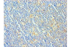 Immunohistochemistry of paraffin-embedded human tonsil tissue using ABIN7173325 at dilution of 1:100 (TCOF1 抗体  (AA 1189-1488))
