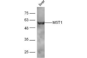 Mouse liver lysates probed with Rabbit Anti-MST1 Polyclonal Antibody, Unconjugated  at 1:5000 for 90 min at 37˚C. (MST1 抗体  (AA 385-487))