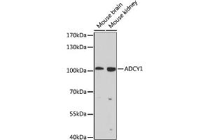 Western blot analysis of extracts of various cell lines, using  antibody (ABIN6129203, ABIN6136557, ABIN6136558 and ABIN6225082) at 1:1000 dilution. (ADCY1 抗体  (AA 470-610))