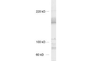 dilution: 1 : 1000, sample: synaptic membrane fraction of rat brain (LP1) (Neurexin 3 抗体  (AA 1298-1494))