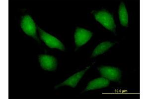 Immunofluorescence of purified MaxPab antibody to LIMK2 on HeLa cell. (LIMK2 抗体  (AA 1-686))