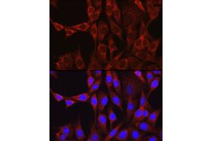 Immunofluorescence analysis of NIH/3T3 cells using [KO Validated] Glutamine Synthetase (GLUL) Rabbit pAb (ABIN6130425, ABIN6141161, ABIN6141162 and ABIN7101772) at dilution of 1:100 (40x lens).