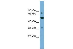 TLK2 antibody used at 0. (TLK2 抗体  (N-Term))