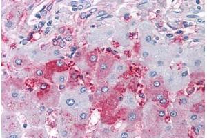 Human Liver (formalin-fixed, paraffin-embedded) stained with DUSP26 antibody ABIN213523 at 10 ug/ml followed by biotinylated goat anti-rabbit IgG secondary antibody ABIN481713, alkaline phosphatase-streptavidin and chromogen. (DUSP26 抗体  (Internal Region))