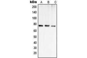 Western blot analysis of OATP1 expression in Jurkat (A), MCF7 (B), SHSY5Y (C) whole cell lysates. (SLCO1A2 抗体  (Center))