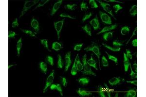 Immunofluorescence of monoclonal antibody to TOMM20 on HeLa cell. (TOMM20 抗体  (AA 1-145))