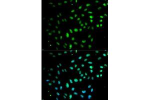 Immunofluorescence analysis of MCF7 cell using CD27 antibody. (CD27 抗体  (AA 20-191))