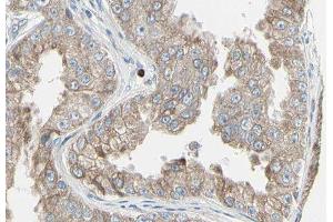 ABIN6278831 at 1/100 staining Human prostate tissue by IHC-P. (ADCY7 抗体  (Internal Region))