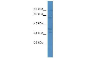 CA5A antibody used at 0. (CA5A 抗体  (C-Term))