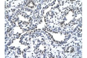Rabbit Anti-ZNF212 antibody   Paraffin Embedded Tissue: Human Lung cell Cellular Data: alveolar cell of renal tubule Antibody Concentration: 4. (ZNF212 抗体  (N-Term))