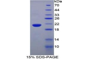 SDS-PAGE analysis of Rat Ubiquitin D Protein. (UBD 蛋白)