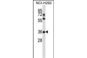 NSA Antibody (C-term) 13772b western blot analysis in NCI- cell line lysates (35 μg/lane).