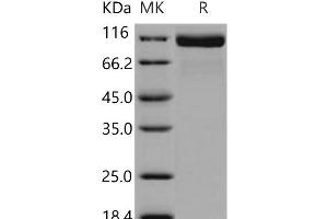 Western Blotting (WB) image for Angiotensin I Converting Enzyme 2 (ACE2) protein (His tag) (ABIN7320348)
