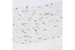 Immunohistochemistry of paraffin-embedded human stomach using CSRP3 Antibody (ABIN2562048) at dilution of 1:100 (40x lens). (CSRP3 抗体)