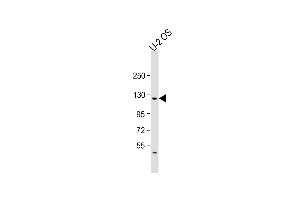 Anti-LIFR Antibody (C-term) at 1:2000 dilution + U-2OS whole cell lysate Lysates/proteins at 20 μg per lane. (LIFR 抗体  (C-Term))