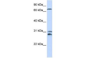 TLK2 antibody used at 1 ug/ml to detect target protein. (TLK2 抗体  (N-Term))