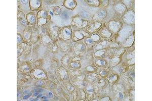 Immunohistochemistry of paraffin-embedded Human esophagus using DEFB132 Polyclonal Antibody at dilution of 1:100 (40x lens). (DEFB132 抗体)