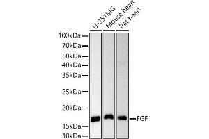 Western blot analysis of extracts of various cell lines, using FGF1 antibody (ABIN3021072, ABIN3021073, ABIN3021074 and ABIN6213939) at 1:1000 dilution. (FGF1 抗体  (AA 16-155))
