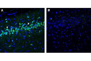 Expression of NPFFR1 in rat hippocampus.