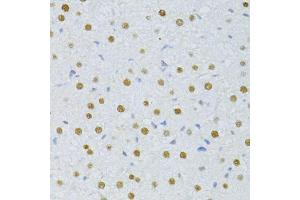 Immunohistochemistry of paraffin-embedded rat liver using SNRNP70 antibody. (SNRNP70 抗体  (AA 150-250))