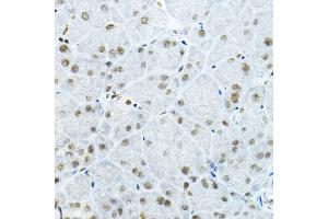 Immunohistochemistry of paraffin-embedded mouse pancreas using GB Rabbit pAb (ABIN6127943, ABIN6140978, ABIN6140979 and ABIN6225075) at dilution of 1:100 (40x lens). (GATAD2B 抗体  (AA 1-120))