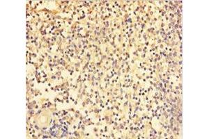 Immunohistochemistry of paraffin-embedded human spleen tissue using ABIN7172243 at dilution of 1:100 (TRAF5 抗体  (AA 1-557))