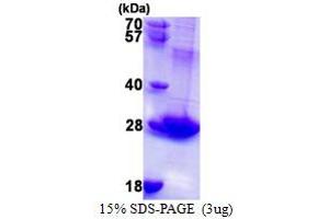 RAB3B, Member RAS Oncogene Family (RAB3B) (AA 1-219) protein (His tag)