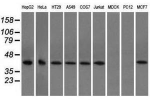Image no. 6 for anti-Acetyl-CoA Acetyltransferase 2 (ACAT2) antibody (ABIN1496399)