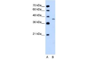 WB Suggested Anti-DHODH  Antibody Titration: 0. (DHODH 抗体  (C-Term))