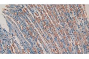 Detection of CHEM in Mouse Stomach Tissue using Polyclonal Antibody to Chemerin (CHEM) (Chemerin 抗体  (AA 21-155))