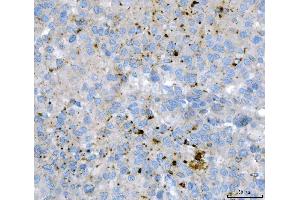 IHC analysis of KLHL12 using anti-KLHL12 antibody (ABIN7601008).