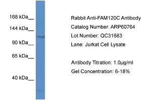Western Blotting (WB) image for anti-Family with Sequence Similarity 120C (FAM120C) (N-Term) antibody (ABIN2788566) (FAM120C 抗体  (N-Term))