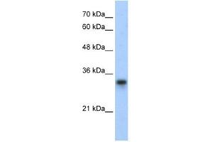 RPL8 antibody used at 0. (RPL8 抗体  (C-Term))