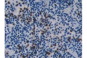 Immunohistochemistry (IHC) image for anti-Receptor-Interacting serine-threonine Kinase 3 (RIPK3) (AA 16-239) antibody (ABIN7439729)