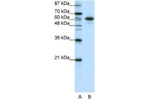 CBLL1 antibody (20R-1225) used at 0. (CBLL1 抗体  (C-Term))