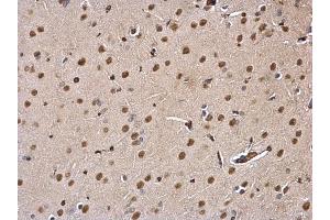 IHC-P Image DDB1 antibody detects DDB1 protein at nucleus and cytosol on rat fore brain by immunohistochemical analysis. (DDB1 抗体  (C-Term))