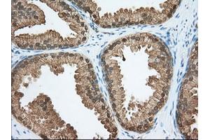 Immunohistochemistry (IHC) image for anti-Acetyl-CoA Acetyltransferase 2 (ACAT2) antibody (ABIN1496403) (ACAT2 抗体)
