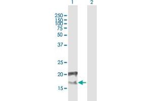 Western Blot analysis of CCDC126 expression in transfected 293T cell line by CCDC126 MaxPab polyclonal antibody. (CCDC126 抗体  (AA 1-140))