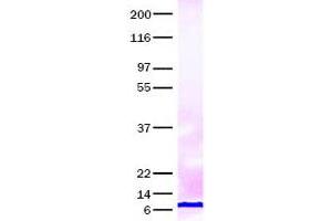 Validation with Western Blot (CCL22 蛋白)
