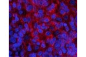 Immunofluorescence analysis of Rat spleen tissue using Phospho-PI 3 kinase p85 alpha /gamma (Tyr467/199) Polyclonal Antibody at dilution of 1:200 (PI3K p85 alpha/gamma 抗体  (pTyr199, pTyr467))