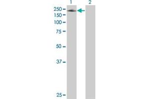 Western Blotting (WB) image for anti-Sema Domain, Transmembrane Domain (TM), and Cytoplasmic Domain, (Semaphorin) 6A (SEMA6A) (AA 1-1030) antibody (ABIN2866303)