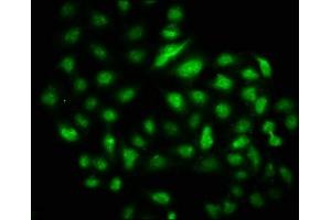 Immunofluorescence staining of Hela cells with ABIN7150197 at 1:133, counter-stained with DAPI. (DMAP1 抗体  (AA 250-300))
